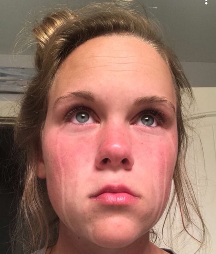 A flushed face with eyes welling, on the edge of crying